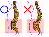 背骨の良い例、悪い例